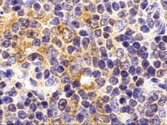 IHC-P analysis of mouse spleen tissue using GTX31294 TLR9 antibody. Working concentration : 2 microg/ml