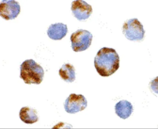 ICC/IF analysis of K562 cells using GTX31296 Bmi1 antibody. Working concentration : 10 microg/ml ICC/IF analysis of K562 cells using GTX31296 Bmi1 antibody. Working concentration : 10 microg/ml