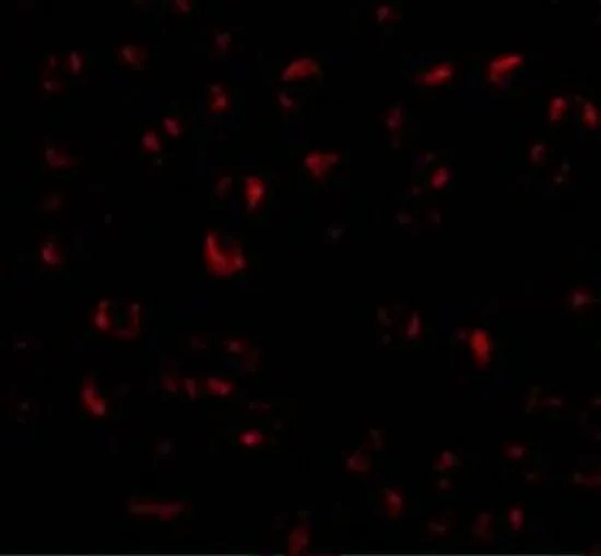 ICC/IF analysis of K562 cells using GTX31296 Bmi1 antibody. Working concentration : 20 microg/ml