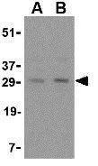 WB analysis of rat liver tissue lysate using GTX31300 sRANKL antibody. Working concentration : (A) 0.25 and (B) 0.5 microg/ml WB analysis of rat liver tissue lysate using GTX31300 sRANKL antibody. Working concentration : (A) 0.25 and (B) 0.5 microg/ml