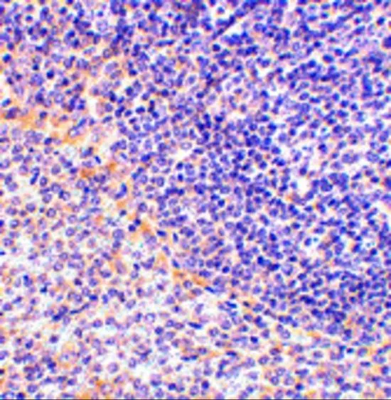 IHC-P analysis of rat spleen tissue using GTX31302 FAF1 antibody. Working concentration : 2.5 microg/ml