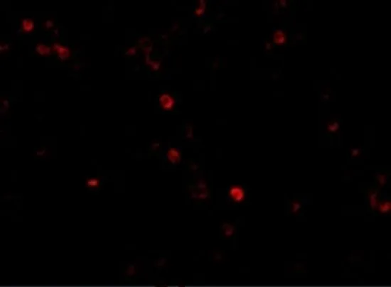 IHC-P analysis of human lymph node tissue using GTX31304 MDA5 antibody. Working concentration : 20 microg/ml IHC-P analysis of human lymph node tissue using GTX31304 MDA5 antibody. Working concentration : 20 microg/ml