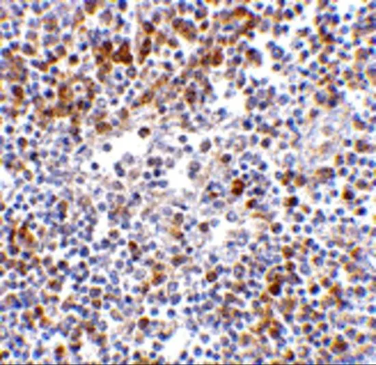 IHC-P analysis of human lymph node tissue using GTX31304 MDA5 antibody. Working concentration : 5 microg/ml