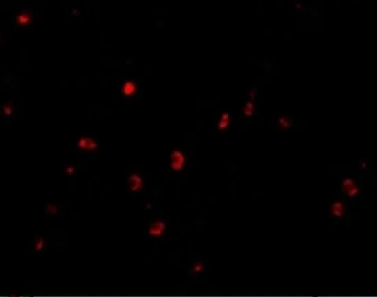 IHC-P analysis of human colon tissue using GTX31310 CD82 antibody. Working concentration : 20 microg/ml IHC-P analysis of human colon tissue using GTX31310 CD82 antibody. Working concentration : 20 microg/ml