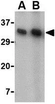 WB analysis of A549 cell lysate using GTX31310 CD82 antibody. Working concentration : (A) 0.5 and (B) 1 microg/ml