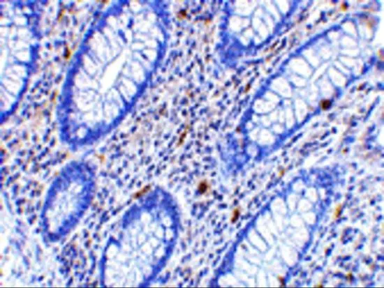 IHC-P analysis of human colon tissue using GTX31310 CD82 antibody. Working concentration : 2.5 microg/ml