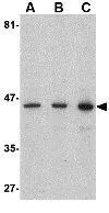 WB analysis of human brain tissue lysate using GTX31313 Presenilin 1 antibody. Working concentration : (A) 0.5, (B) 1, and (C) 2 microg/ml
