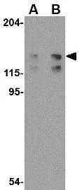WB analysis of K562 cell lysate using GTX31318 FYB antibody. Working concentration : (A) 0.5 and (B) 1 microg/ml