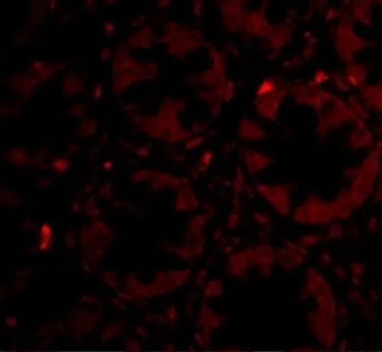 IHC-P analysis of human colon tissue using GTX31321 CCK4 antibody. Working concentration : 20 microg/ml IHC-P analysis of human colon tissue using GTX31321 CCK4 antibody. Working concentration : 20 microg/ml