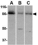 WB analysis of (A) human colon, (B) mouse kidney and (C) rat liver tissue lysate using GTX31321 CCK4 antibody. Working concentration : 1 microg/ml