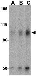WB analysis of human brain tissue lysate using GTX31328 GluR6 antibody. Working concentration : (A) 0.5 and (B) 1 microg/ml WB analysis of human brain tissue lysate using GTX31328 GluR6 antibody. Working concentration : (A) 0.5 and (B) 1 microg/ml