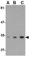 WB analysis of SK-N-SH cell lysate using GTX31329 ATG10 antibody. Working concentration : (A) 0.5, (B) 1, and (C) 2 microg/ml WB analysis of SK-N-SH cell lysate using GTX31329 ATG10 antibody. Working concentration : (A) 0.5, (B) 1, and (C) 2 microg/ml