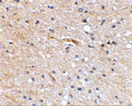 IHC-P analysis of human brain tissue using GTX31331 FBXL20 antibody. Working concentration : 2.5 microg/ml