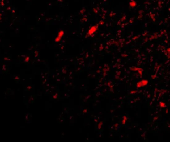IHC-P analysis of human brain tissue using GTX31331 FBXL20 antibody. Working concentration : 20 microg/ml