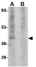 WB analysis of human brain tissue lysate in the (A) absence and (B) presence of blocking peptide using GTX31334 RIMS3 antibody. Working concentration : 1 microg/ml WB analysis of human brain tissue lysate in the (A) absence and (B) presence of blocking peptide using GTX31334 RIMS3 antibody. Working concentration : 1 microg/ml