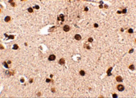 IHC-P analysis of human brain tissue using GTX31334 RIMS3 antibody. Working concentration : 2.5 microg/ml