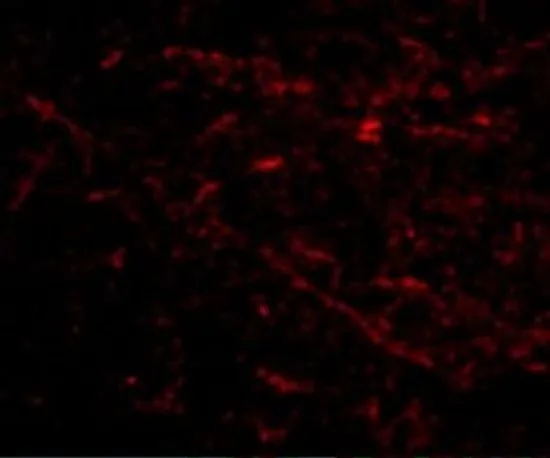 IHC-P analysis of human brain tissue using GTX31335 SIRT2 antibody. Working concentration : 5 microg/ml