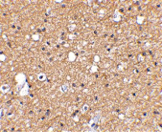 IHC-P analysis of human brain tissue using GTX31335 SIRT2 antibody. Working concentration : 2.5 microg/ml