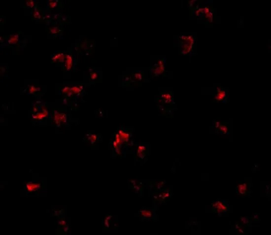 ICC/IF analysis of K562 cells using GTX31339 GRTP1 antibody. Working concentration : 20 microg/ml
