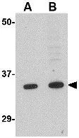 WB analysis of K562 cell lysate using GTX31339 GRTP1 antibody. Working concentration : (A) 1 and (B) 2 microg/ml