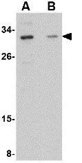 WB analysis of SK-N-SH cell lysate in the (A) absence and (B) presence of blocking peptide using GTX31340 GRTP1 antibody. Working concentration : 1 microg/ml WB analysis of SK-N-SH cell lysate in the (A) absence and (B) presence of blocking peptide using GTX31340 GRTP1 antibody. Working concentration : 1 microg/ml