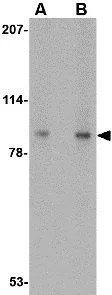 WB analysis of 293 cell lysate using GTX31341 VPS53 antibody. Working concentration : (A) 0.5 and (B) 1 ug/ml
