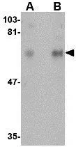 WB analysis of rat brain tissue lysate using GTX31347 CPEB1 antibody. Working concentration : (A) 1 and (B) 2 microg/ml