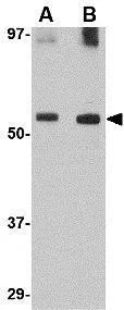 WB analysis of SK-N-SH cell lysate using GTX31348 GDF6 antibody. Working concentration : (A) 0.5 and (B) 1 microg/ml WB analysis of SK-N-SH cell lysate using GTX31348 GDF6 antibody. Working concentration : (A) 0.5 and (B) 1 microg/ml