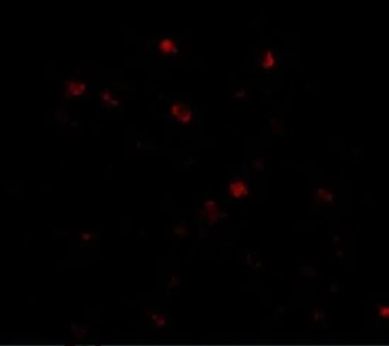 IHC-P analysis of human brain tissue using GTX31354 NUP160 antibody. Working concentration : 20 microg/ml IHC-P analysis of human brain tissue using GTX31354 NUP160 antibody. Working concentration : 20 microg/ml