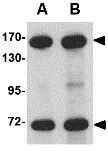 WB analysis of rat brain tissue lysate using GTX31354 NUP160 antibody. Working concentration : (A) 0.5 and (B) 1 microg/ml