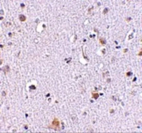 IHC-P analysis of human brain tissue using GTX31354 NUP160 antibody. Working concentration : 2.5 microg/ml