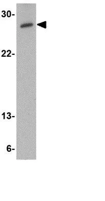 WB analysis of human testis tissue lysate using GTX31355 MED4 antibody. Working concentration : 0.5 microg/ml WB analysis of human testis tissue lysate using GTX31355 MED4 antibody. Working concentration : 0.5 microg/ml