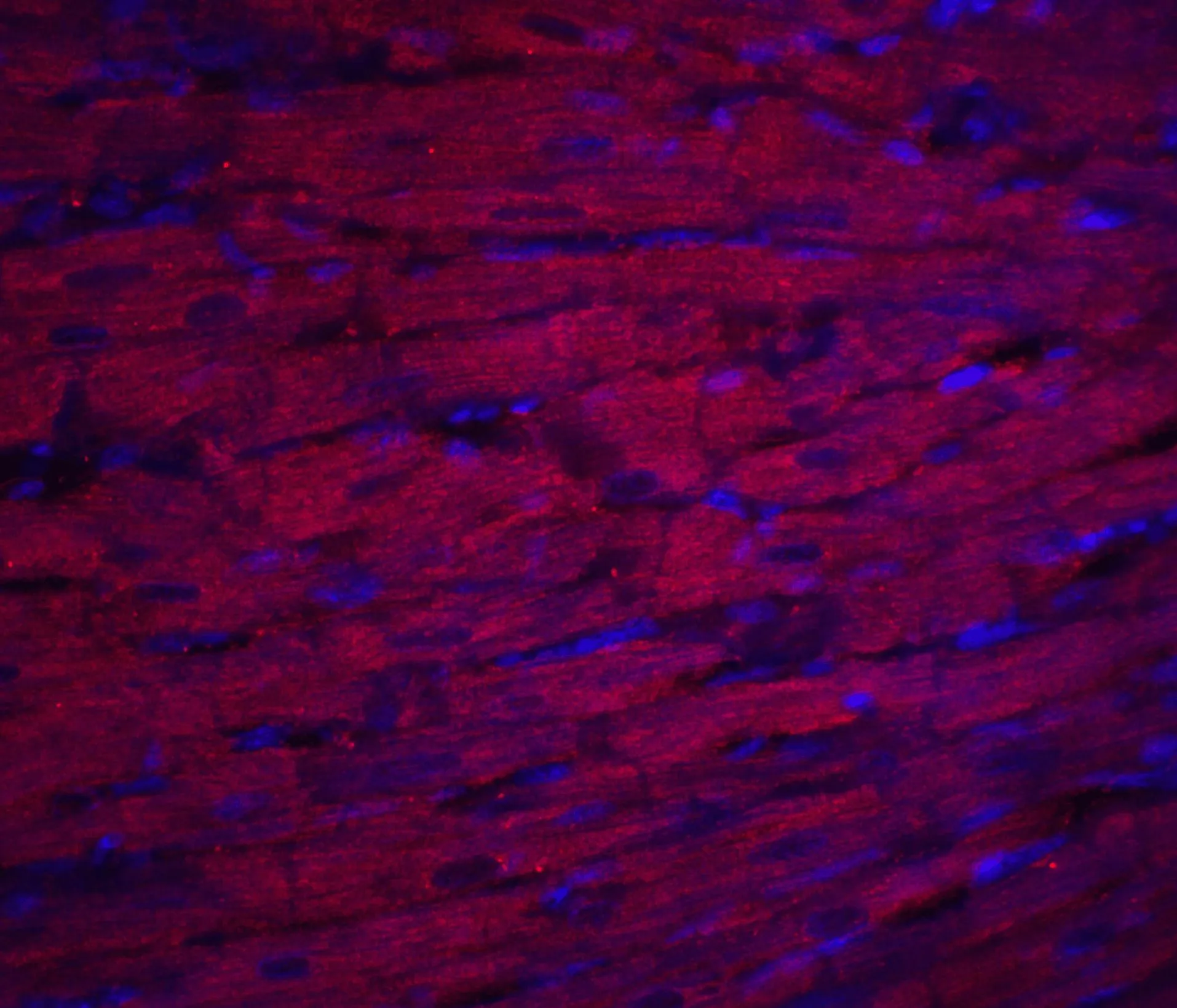 IHC-P analysis of rat heart tissue using GTX31356 ASAH1 antibody. Red : Primary antibody Blue : DAPI Dilution : 20 microg/ml