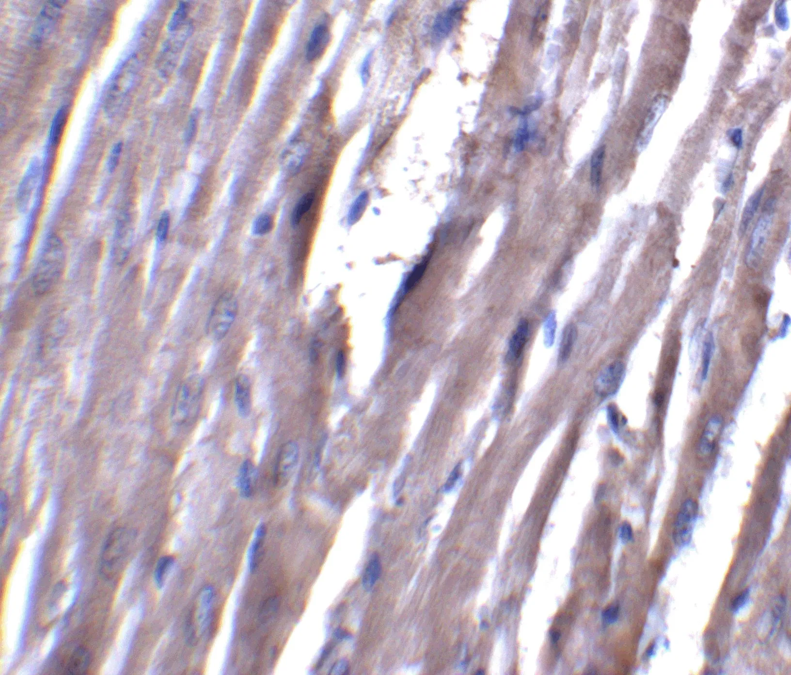 IHC-P analysis of rat heart tissue using GTX31356 ASAH1 antibody. Dilution : 5 microg/ml