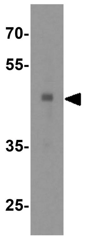 WB analysis of human heart tissue lysate using GTX31356 ASAH1 antibody. Working concentration : 1 microg/ml