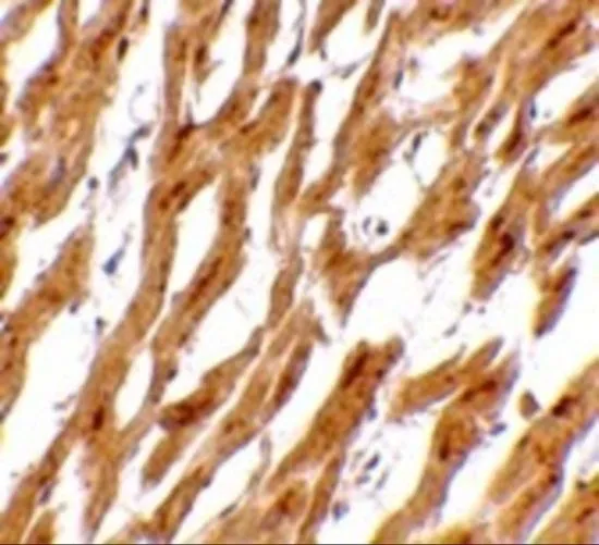 IHC-P analysis of human heart tissue using GTX31356 ASAH1 antibody. Working concentration : 2.5 microg/ml