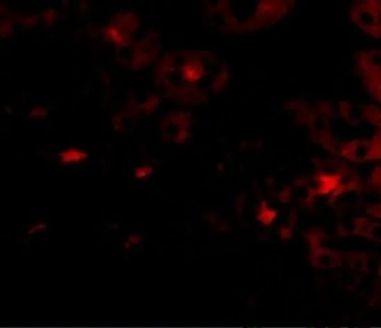 IHC-P analysis of human kidney tissue using GTX31361 OTUD5 antibody. Working concentration : 20 microg/ml IHC-P analysis of human kidney tissue using GTX31361 OTUD5 antibody. Working concentration : 20 microg/ml