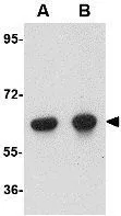 WB analysis of human kidney tissue lysate using GTX31361 OTUD5 antibody. Working concentration : (A) 1 and (B) 2 microg/ml