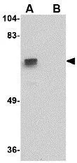 WB analysis of A-20 cell lysate in (A) the absence and (B) the presence of blocking peptide using GTX31362 ZNF350 antibody. Working concentration : 1 ug/ml