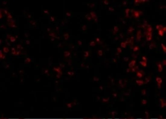 IHC-P analysis of human spleen tissue using GTX31370 KLRA1 antibody. Working concentration : 20 microg/ml IHC-P analysis of human spleen tissue using GTX31370 KLRA1 antibody. Working concentration : 20 microg/ml