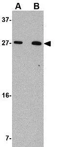 WB analysis of 293 cell lysate using GTX31370 KLRA1 antibody. Working concentration : (A) 1 and (B) 2 microg/ml
