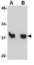 WB analysis of mouse spleen tissue lysate using GTX31371 KLRA1 antibody. Working concentration : (A) 1 and (B) 2 microg/ml