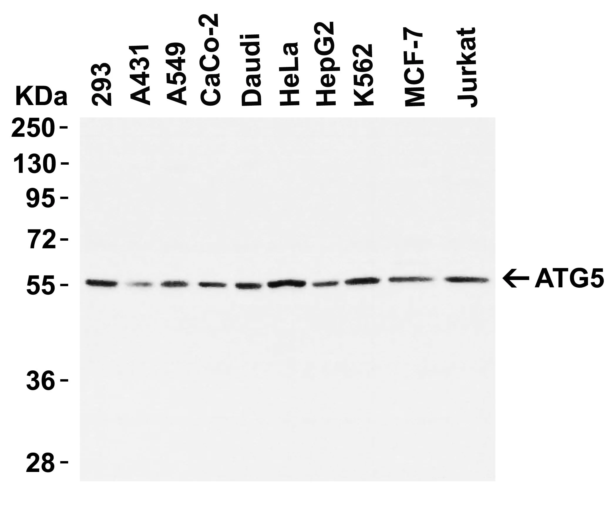 WB analysis of various sample lysates using GTX31372 ATG5 antibody. Loading : 15microg of lysates per lane Dilution : 2 microg/ml WB analysis of various sample lysates using GTX31372 ATG5 antibody. Loading : 15microg of lysates per lane Dilution : 2 microg/ml