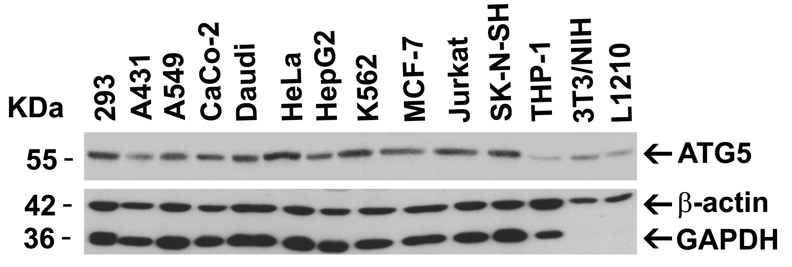 WB analysis of various sample lysates using GTX31372 ATG5 antibody. Loading : 15microg of lysates per lane Dilution : 2 microg/ml