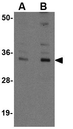 WB analysis of mouse spleen tissue lysate using GTX31372 ATG5 antibody. Working concentration : (A) 1 and (B) 2 microg/ml