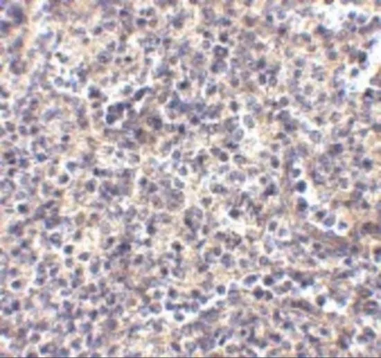 IHC-P analysis of human spleen tissue using GTX31372 ATG5 antibody. Working concentration : 2.5 microg/ml