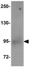 WB analysis of A549 cell lysate using GTX31375 DREF antibody. Working concentration : 1 microg/ml WB analysis of A549 cell lysate using GTX31375 DREF antibody. Working concentration : 1 microg/ml