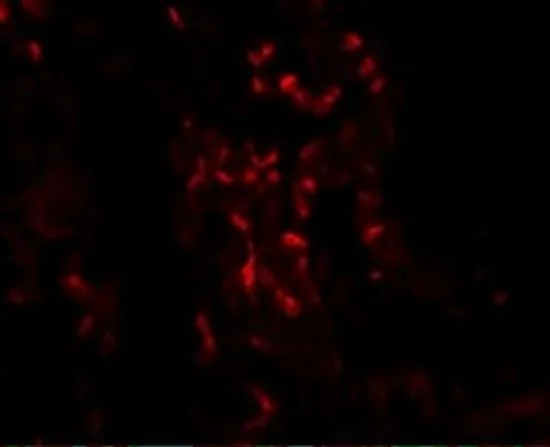 IHC-P analysis of human lung tissue using GTX31378 TNFAIP3 antibody. Working concentration : 20 microg/ml IHC-P analysis of human lung tissue using GTX31378 TNFAIP3 antibody. Working concentration : 20 microg/ml