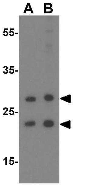 IHC-P analysis of mouse brain tissue using GTX31379 SCF antibody. Working concentration : 2.5 ug/ml