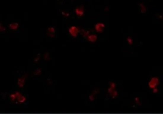 ICC/IF analysis of A549 cells using GTX31381 CD81 antibody. Working concentration : 20 microg/ml ICC/IF analysis of A549 cells using GTX31381 CD81 antibody. Working concentration : 20 microg/ml